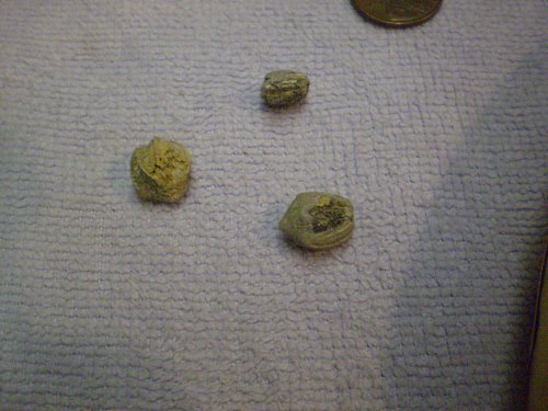 Blastoids, approx 1/2 inch.